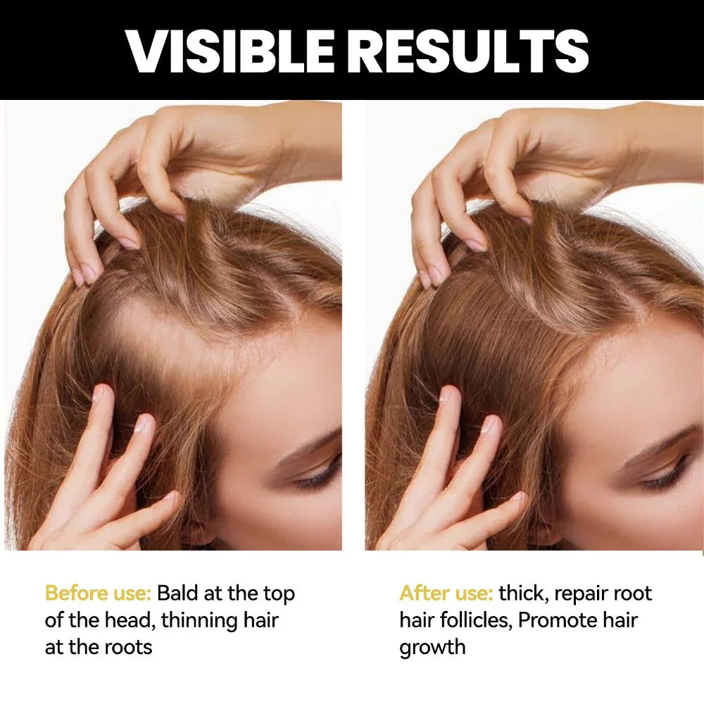 Huile Essentielle Densifiante pour la Pousse des Cheveux Hommes & Femmes