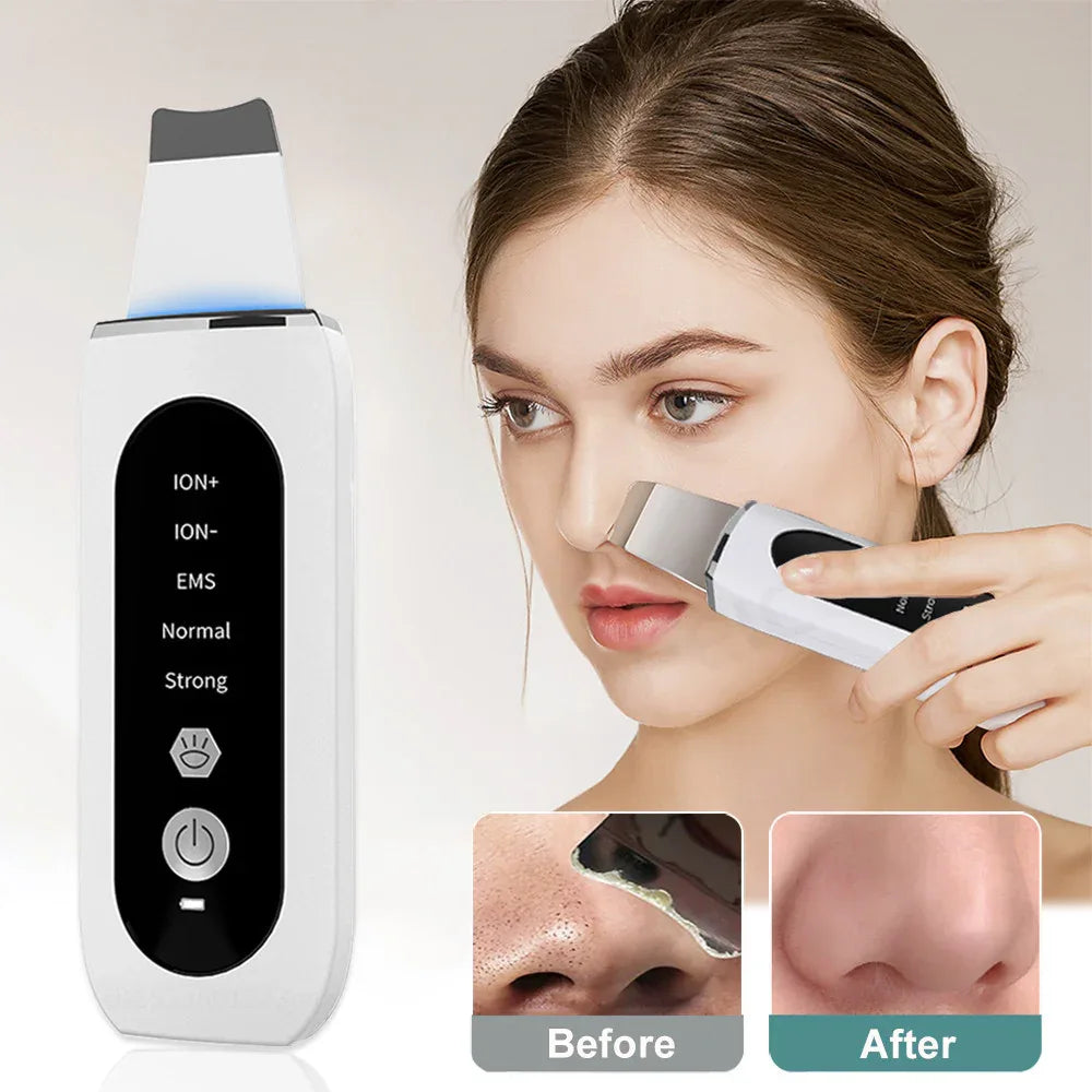 Nettoyant Facial Ultrasonique Pour Le Soin De La Peau et l'Élimination de l'Acné et des Points Noirs