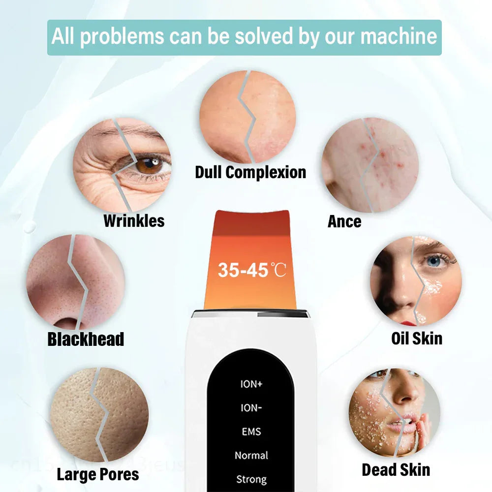 Nettoyant Facial Ultrasonique Pour Le Soin De La Peau et l'Élimination de l'Acné et des Points Noirs