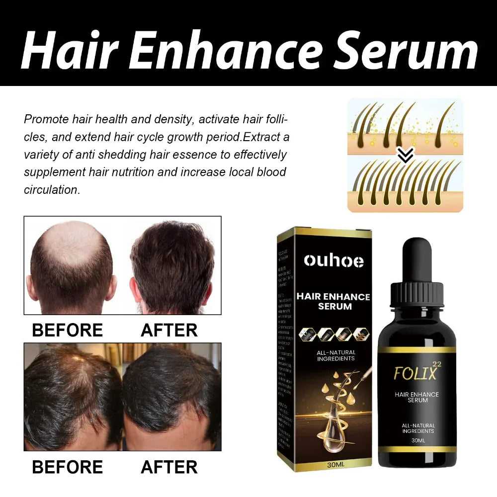 Huile Essentielle Densifiante pour la Pousse des Cheveux Hommes & Femmes