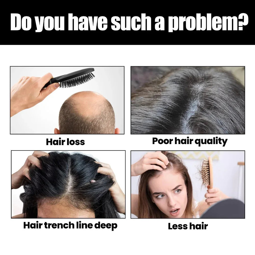 Huile Essentielle Densifiante pour la Pousse des Cheveux Hommes & Femmes