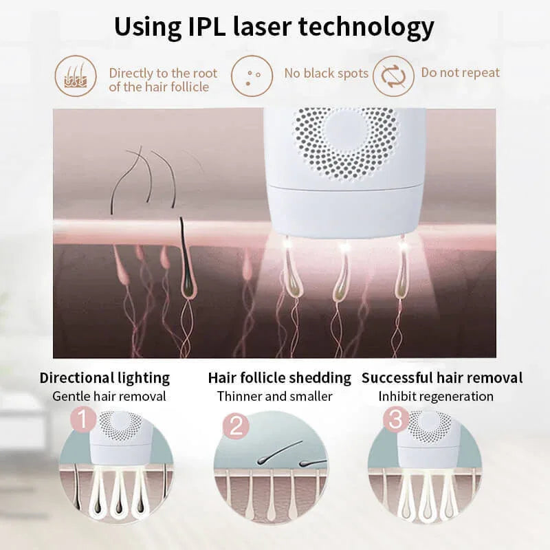 IPL-Haarentfernungsgerät für dauerhafte Haarentfernung mit 990.000 Lichtimpulsen